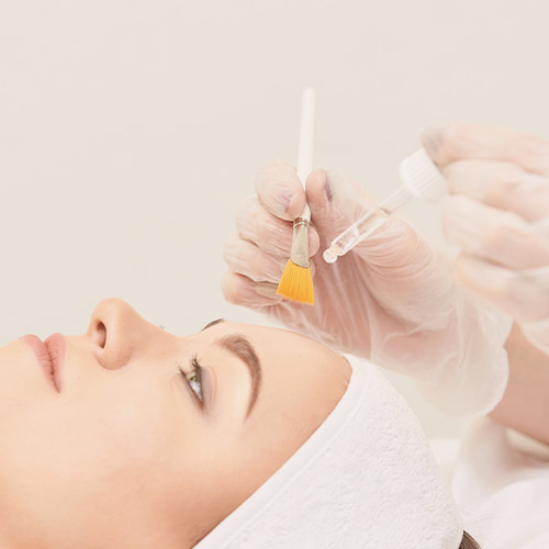 woman getting chemical peel